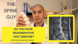 Lumbar Degenerative Disc Disease Part 1 Symptoms and Imaging [upl. by Eramat]