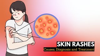 Skin Rash Causes Signs and Symptoms Diagnosis and Treatment [upl. by Stevena641]