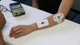 How to set up Iontophoresis [upl. by Eilhsa]