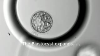 Blastocyst Development  Day 3 to Day 5 MUST SEE [upl. by Waneta]