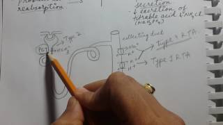 RENAL TUBULAR ACIDOSIS  USMLE STEP 1 [upl. by Zurek733]