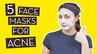 5 Homemade Face Masks for Acne That Really Work [upl. by Dunn647]