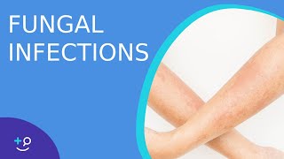 Fungal Infections  Causes Prevention and Cure [upl. by Dotti]