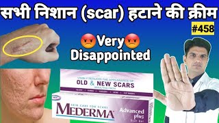 Mederma cream  mederma for acne scars  mederma advanced scar gel review [upl. by Rosalind117]