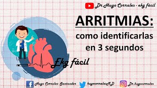 ARRITMIAS CARDÍACAS  como identificarlas en 3 segundos [upl. by Atirahs]